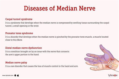 median nerve palsy wikipedia